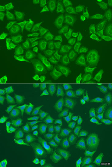 GLYATL1 Rabbit Polyclonal Anti