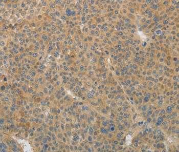 TGFB1 Antibody[35958]