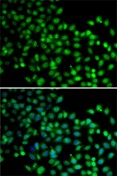 FKBP6 Rabbit Polyclonal Antibo