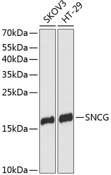 SNCG Rabbit Polyclonal Antibod
