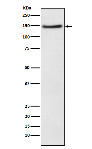 NPC1L1 Rabbit mAb[56507]