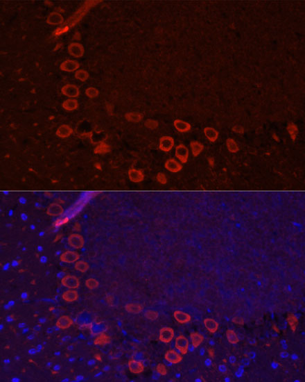 SLC1A1 Rabbit Polyclonal Antib