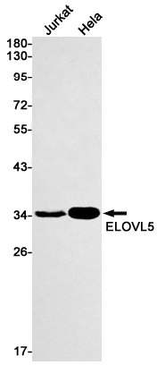 ELOVL5 Rabbit mAb[52005]