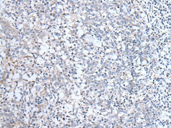 ABCD1 Antibody[43954]