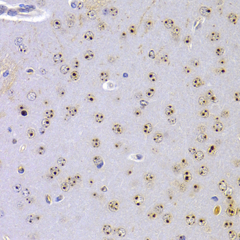 CBX5 Rabbit Polyclonal Antibod