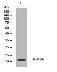 PHF5A rabbit pAb[44277]