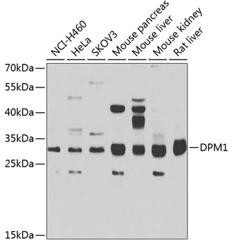DPM1 Rabbit Polyclonal Antibod