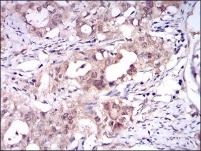 ONECUT3 Mouse mAb[64030]