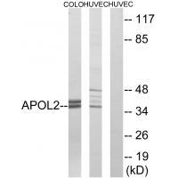 APOL2 Antibody[34432]