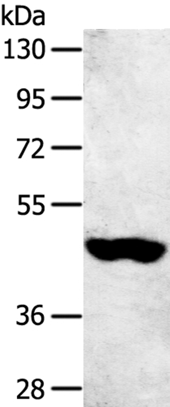 SULT2B1 Antibody[40124]