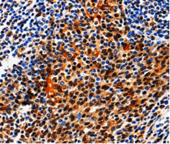 AQP2 Antibody[36759]