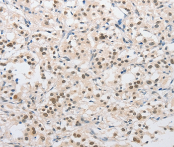 SAE1 Antibody[36160]