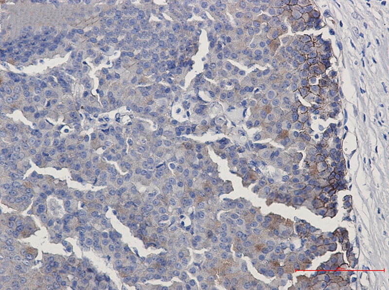 Ephrin Receptor B4 Rabbit mAb[