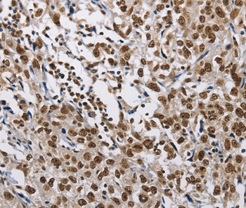 CMTM2 Antibody[35683]
