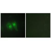 STEA3 Antibody[33932]