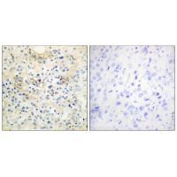 TM16G Antibody[33935]