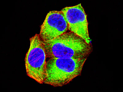 CD126 Mouse mAb[63237]