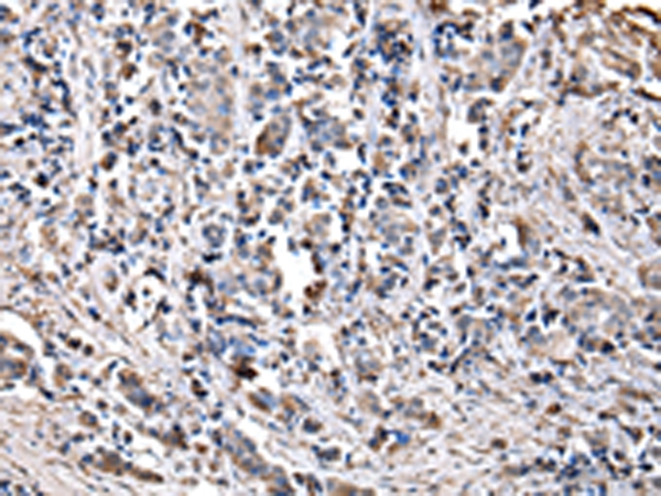 CHMP3 Antibody[42835]