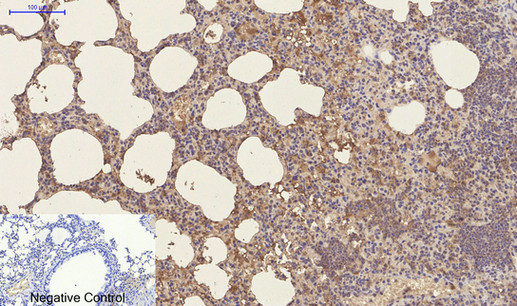 CD23 (3D1) Mouse mAb[26203]