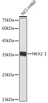 NKX2-1 antibody[38577]