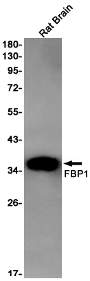FBP1 Rabbit mAb[52279]