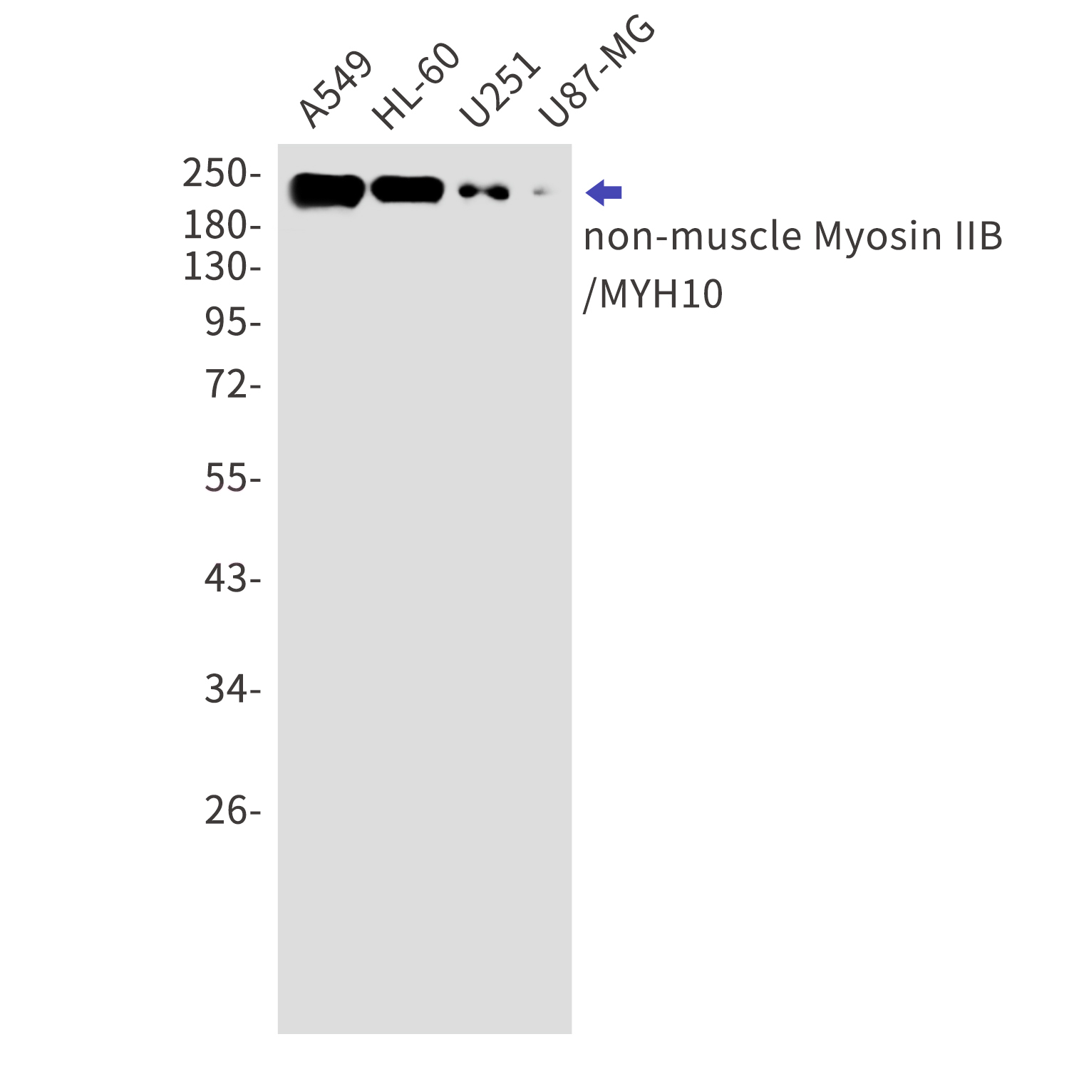 Myosin 10 Rabbit mAb[52823]