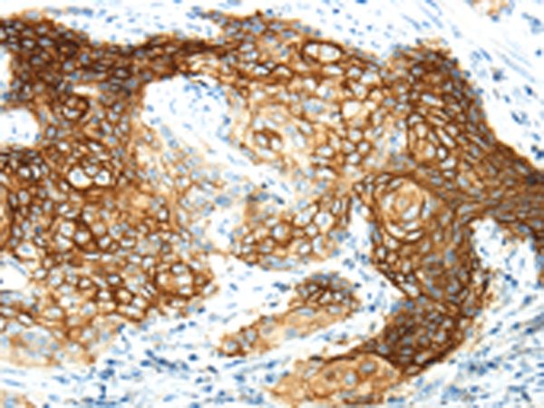 AQP3 Antibody[43394]