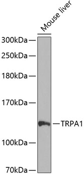 TRPA1 Rabbit Polyclonal Antibo
