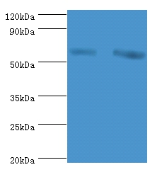 60 kDa SS-A/Ro ribonucleoprote