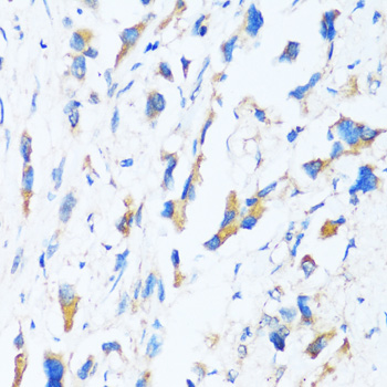 BAG3 Polyclonal Antibody[29195
