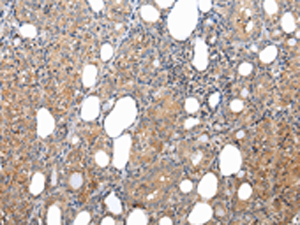 XKRX Antibody[43203]