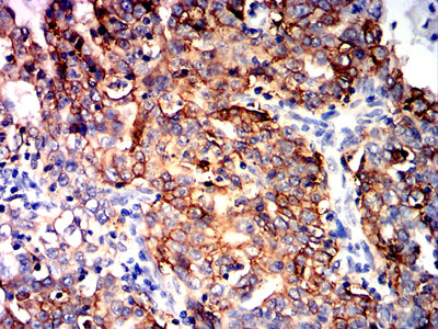 TACSTD2 Mouse mAb[64296]