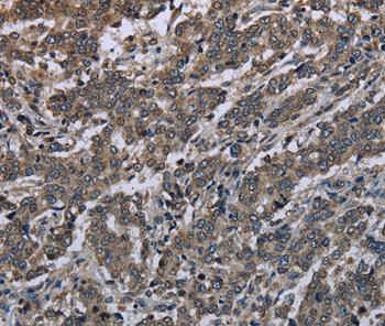 MAPKAPK2 Antibody[37715]