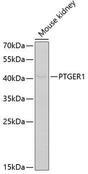 PTGER1 antibody[38495]