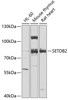 SETDB2 Rabbit Polyclonal Antib