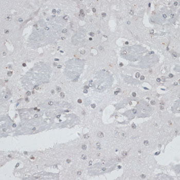 USP7 Polyclonal Antibody[29169