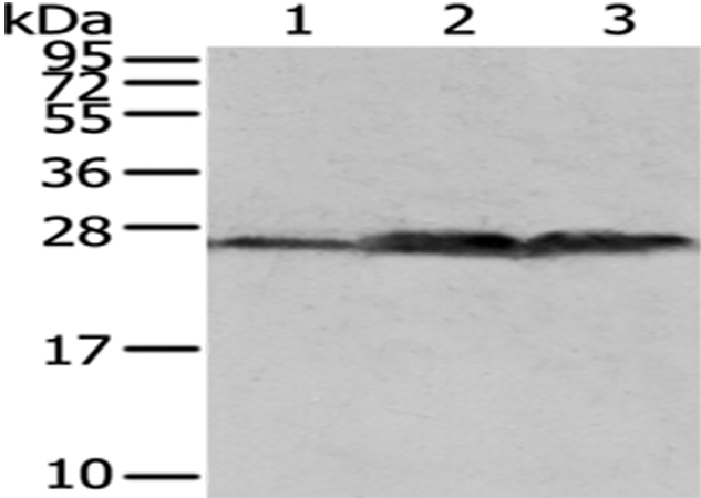 QDPR Antibody[43037]