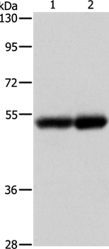 NOTCH4 Antibody[37195]