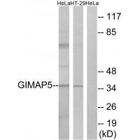 GIMAP5 Antibody[34719]