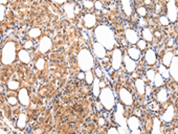 ATF1 Antibody[43228]