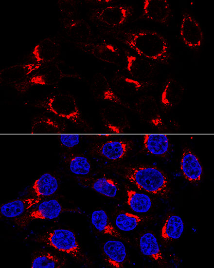 USO1 Rabbit Polyclonal Antibod