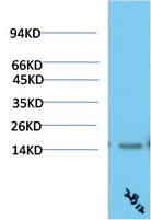 TTR Mouse Monoclonal Antibody(