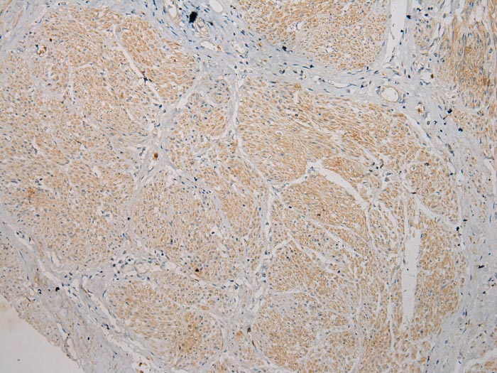 TSPY1 Antibody[40270]