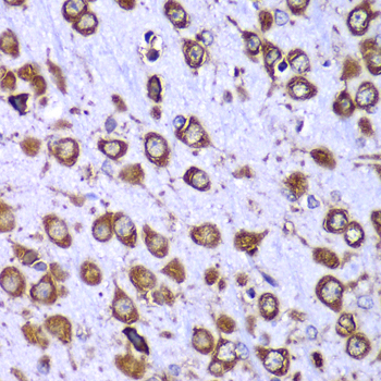 RPS10 Rabbit Polyclonal Antibo