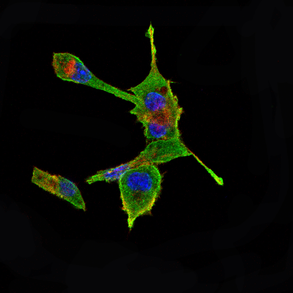 IL-2 Mouse mAb[63781]