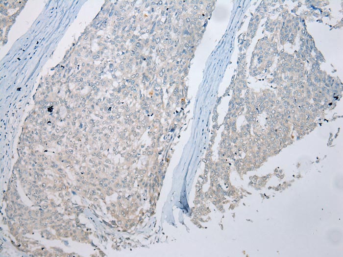 MUC7 Antibody[43220]