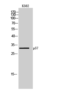 p57 Polyclonal Antibody[41315]