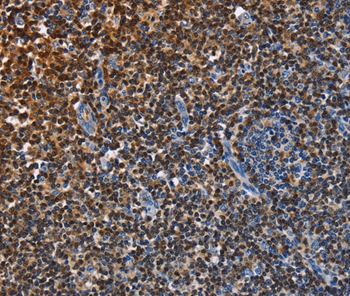 ENPP5 Antibody[35725]