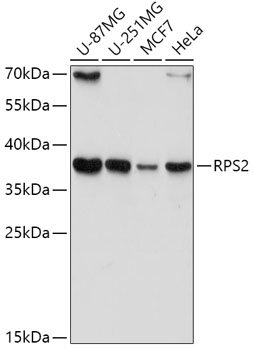 RPS2 Rabbit Polyclonal Antibod