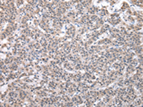 SBDS Antibody[43044]